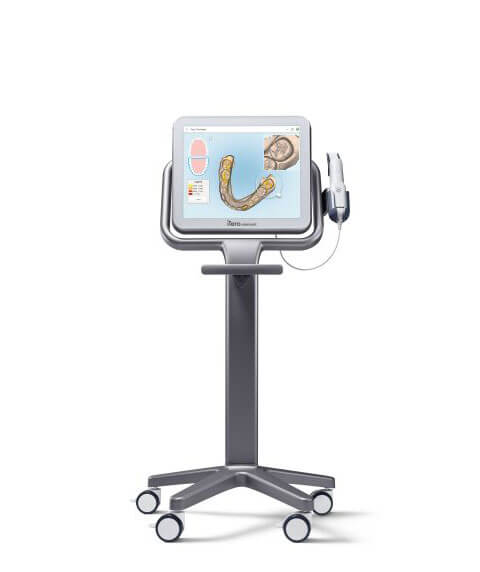 Itero Element intraoral scanner showing the display screen and handpiece